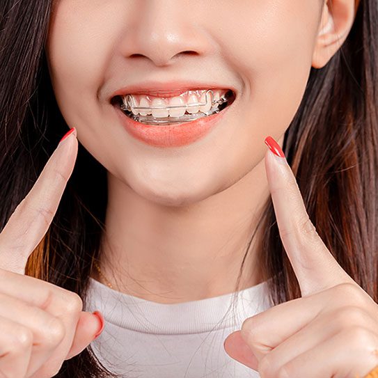A Quick Review of Retainer Care and Use - MyOrthodontist - MyOrthodontist -